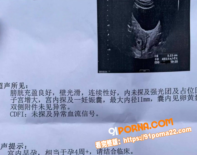 知名演员 李沁 被爆私生...（10）