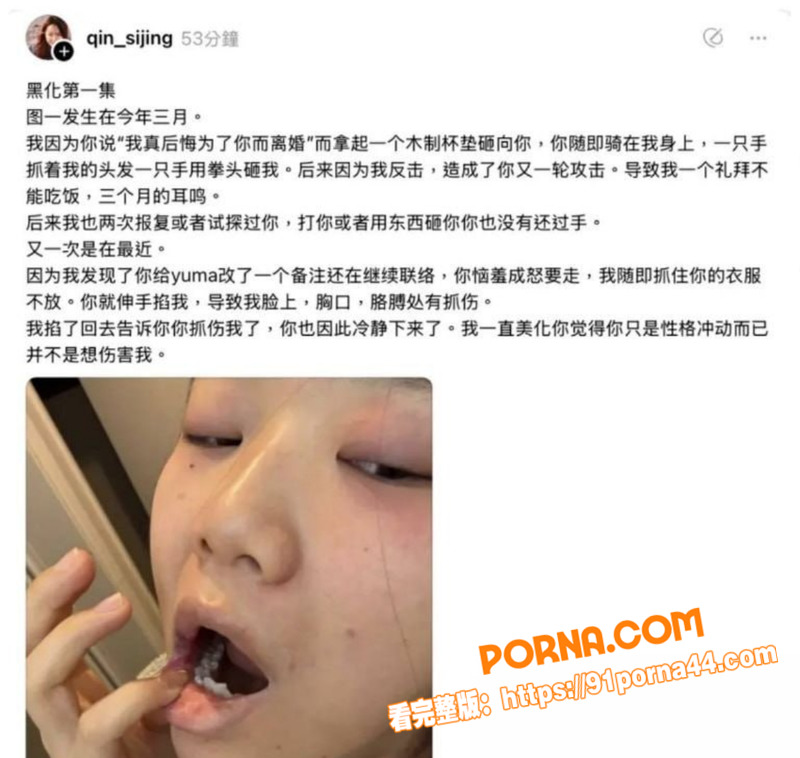 中国画家 秦思静 晒伤照...（11）